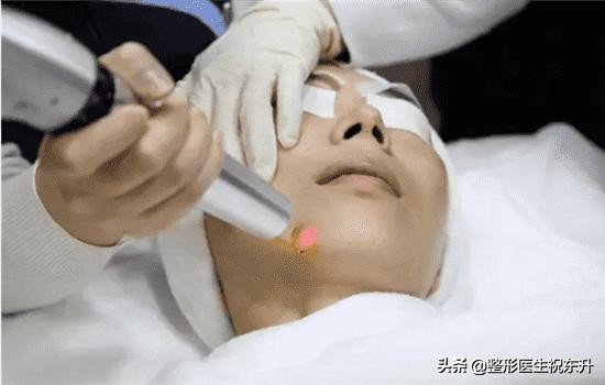 该不该去做皮秒激光手术,皮秒激光到底好不好