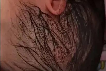 本想让宝宝凉快一下，没想到*处私**感染、蛋蛋被夹坏、面瘫、中毒..