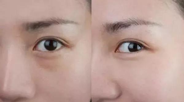 眼霜有必要用好一点的么,眼霜一般有没有用