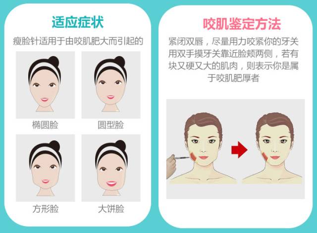 打完瘦脸针后会彻底反弹回去吗,瘦脸针打完会反弹得比以前大吗