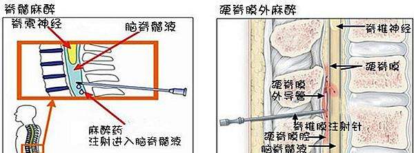 孕期做什么检查才能排除基因问题,孕期要做什么检查能确诊胎停