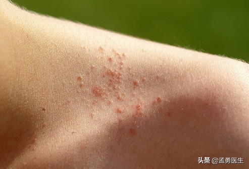 天气热医生科普视频,天气太热了医生提醒