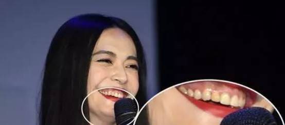 杨颖和姚晨演技,姚晨和杨颖谁的嘴巴大