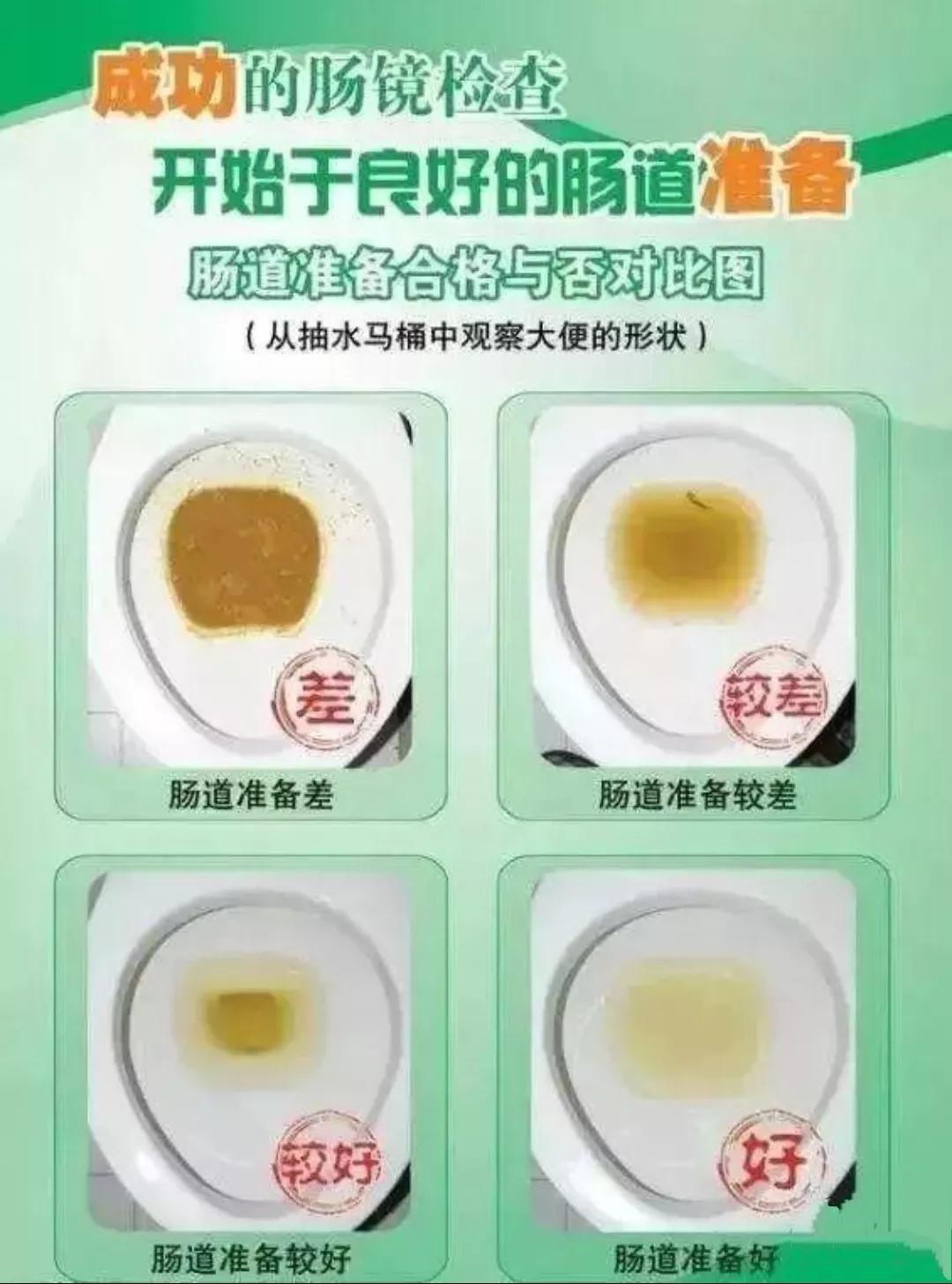 肠镜检查前注意事项及禁忌,肠镜检查前的准备和注意事项图文