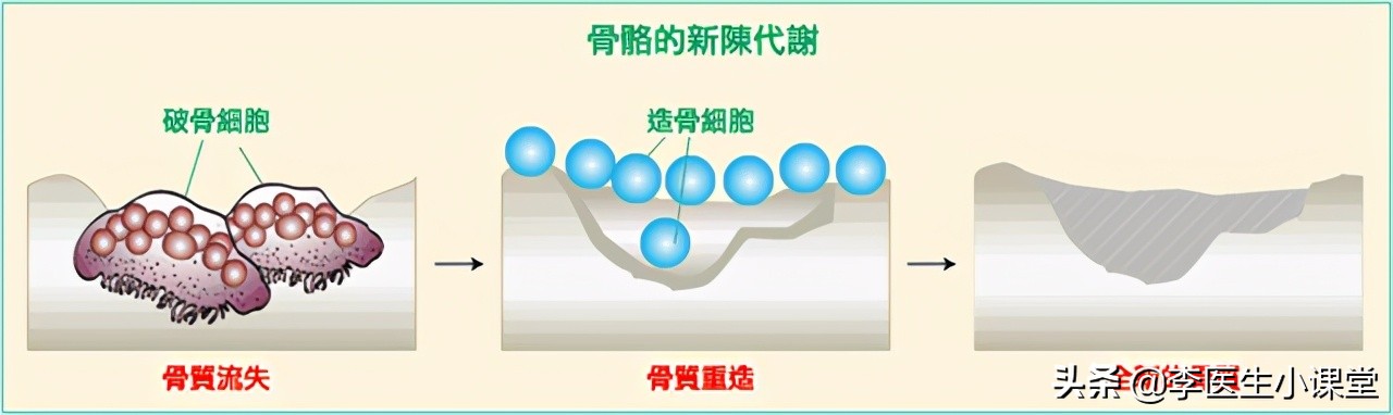 骨质疏松打一年一次的针能止疼吗,老年人骨质疏松最快的恢复办法