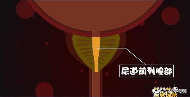 尿不爽,尿不臭是怎么回事