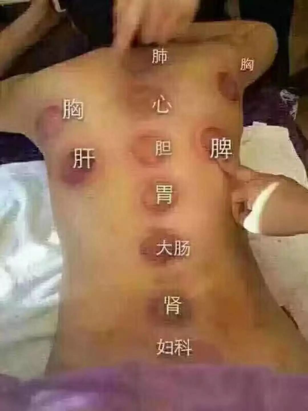 开春养背,冬天养背的最佳方法