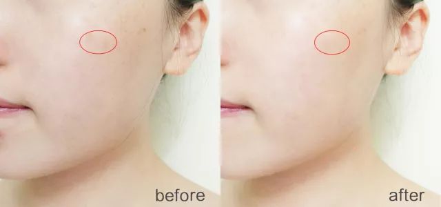 石头姐艾玛斯通拍摄,石头姐艾玛斯通新作品