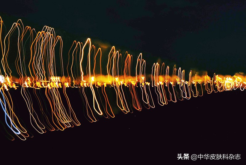 白癜风光疗怎么确定剂量,白癜风308光疗能和311同时用吗