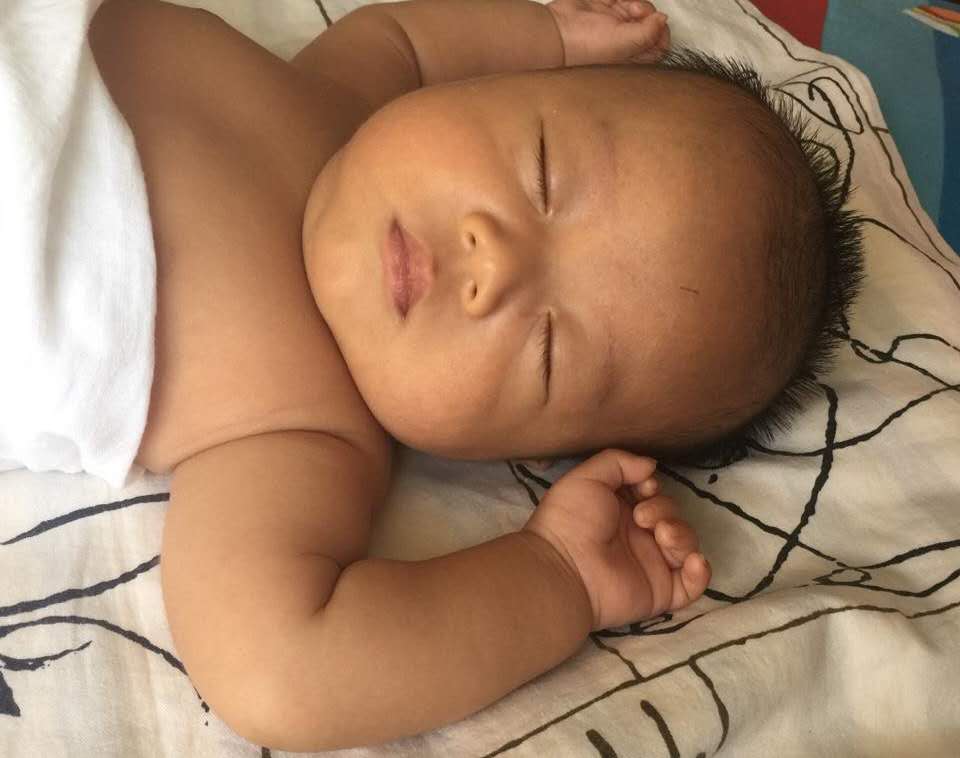 育儿学问：莫把小宝宝的生理现象当病态