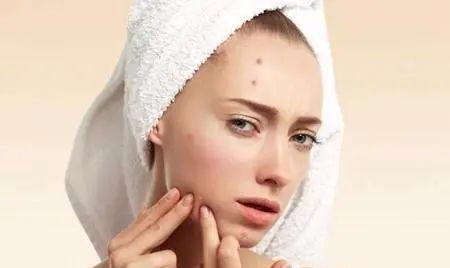 名门泽佳祛痘怎么样,名门泽佳的祛痘怎么样