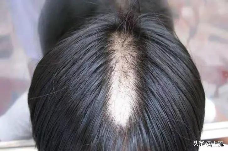 为什么拔倒刺会觉得舒服,忍不住拔手上倒刺怎么办