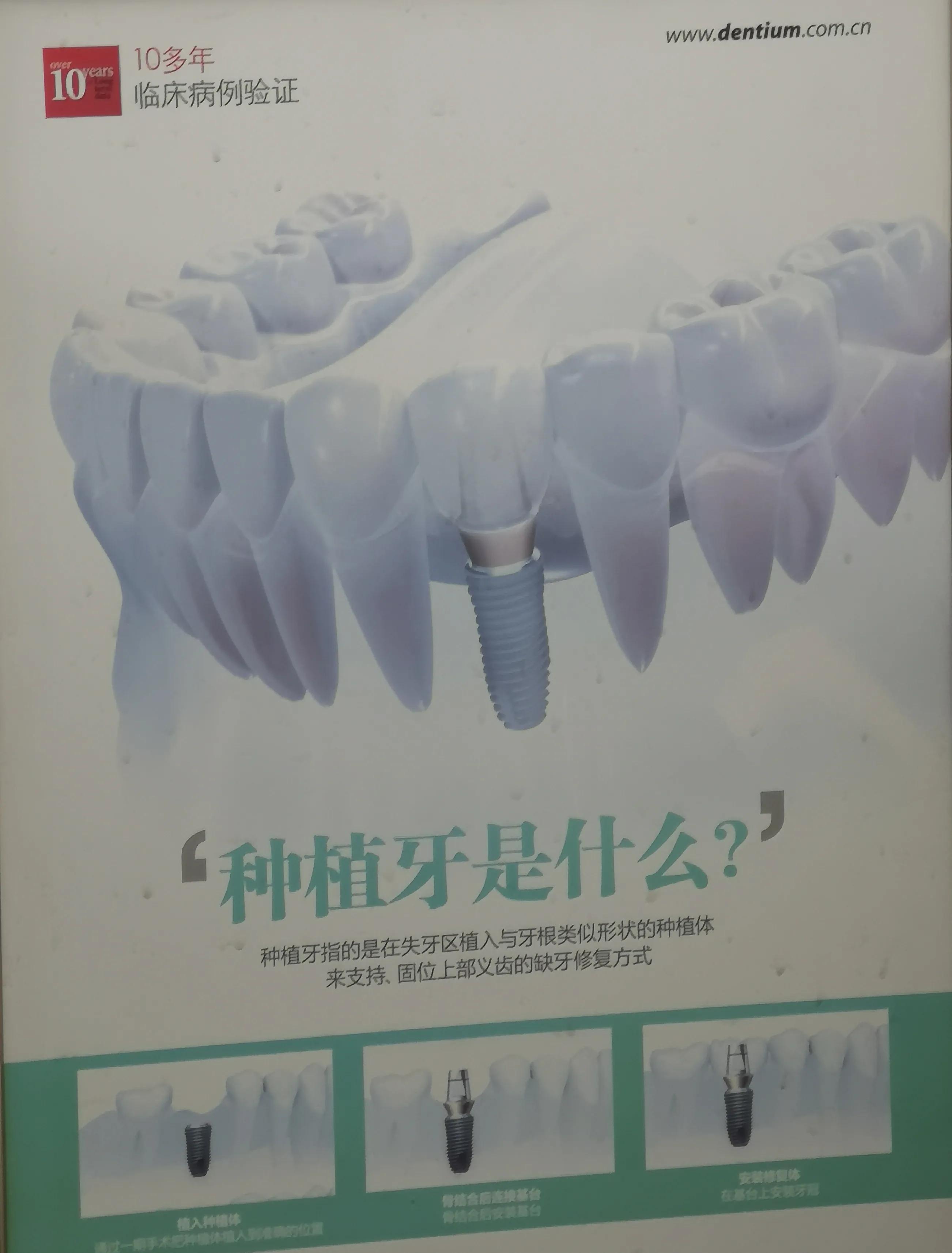 种植全口假牙价格多少,种植上下半口假牙得多少钱视频