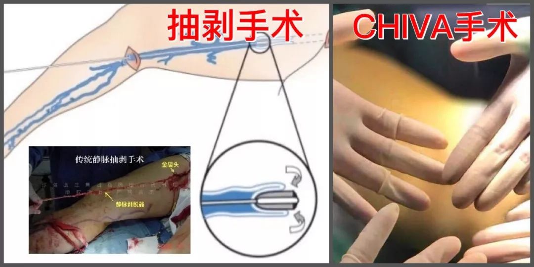 恐飞治疗视频,恐飞症能治好吗