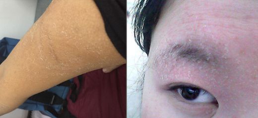 羊奶皂能去鸡皮肤吗,驴奶皂与羊奶皂哪个好