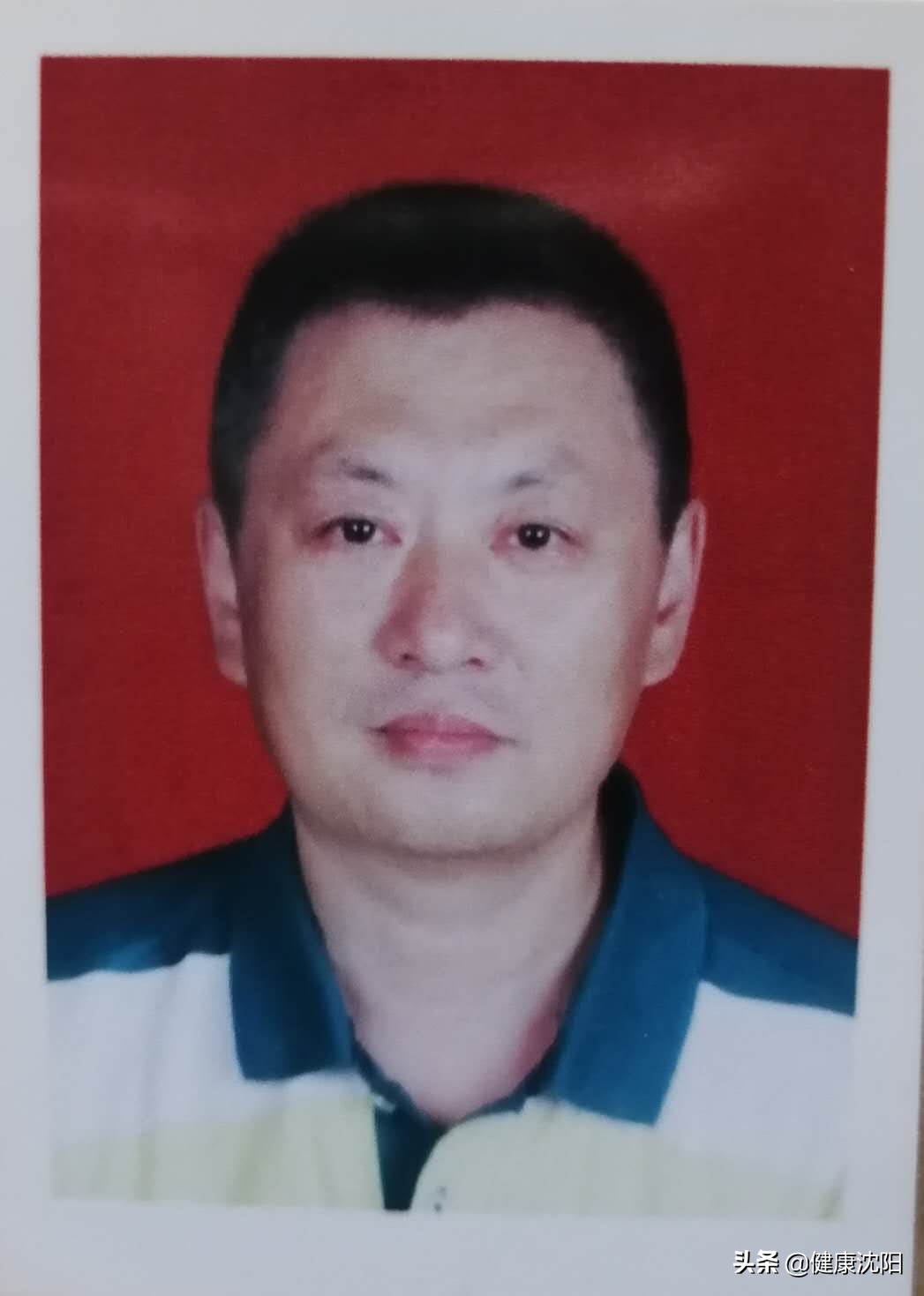 山东开展chiva治疗静脉曲张,chiva是微创治疗静脉曲张吗