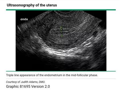子宫内膜偏厚有什么危害吗,子宫内膜厚很危险吗