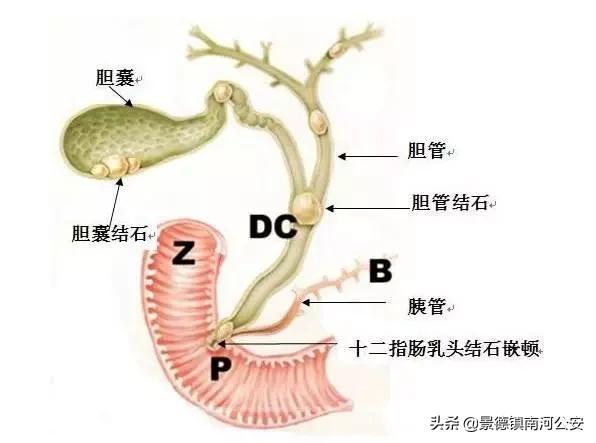 2019全国癌症总数,全国癌症一年死亡人数