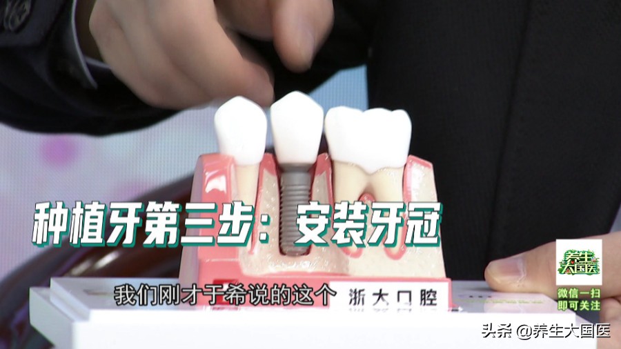 牙齿不整齐怎么修复,牙齿楔状缺损用树脂250好还是350好