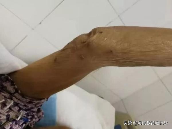 突发！一家五口河南老乐山景区遇险，一人住进ICU！