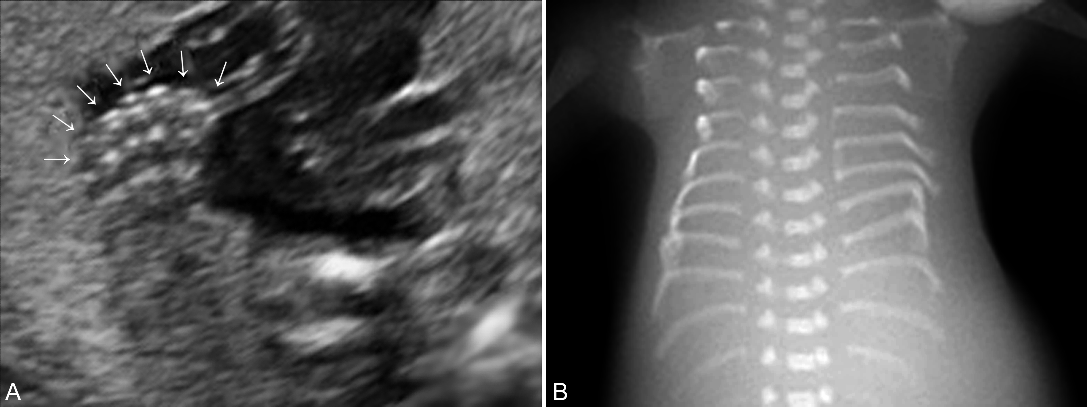 明明白白做b超,明明白白做超声