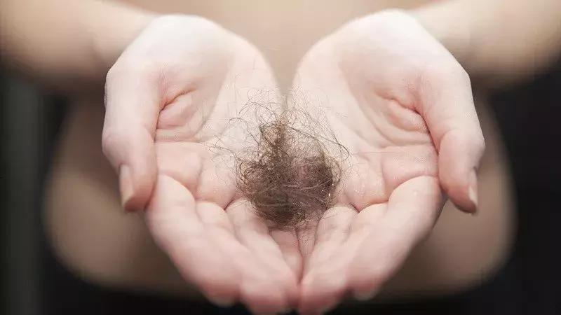 拿什么来拯救我的发际线图片,脱发低龄化如何拯救发际线