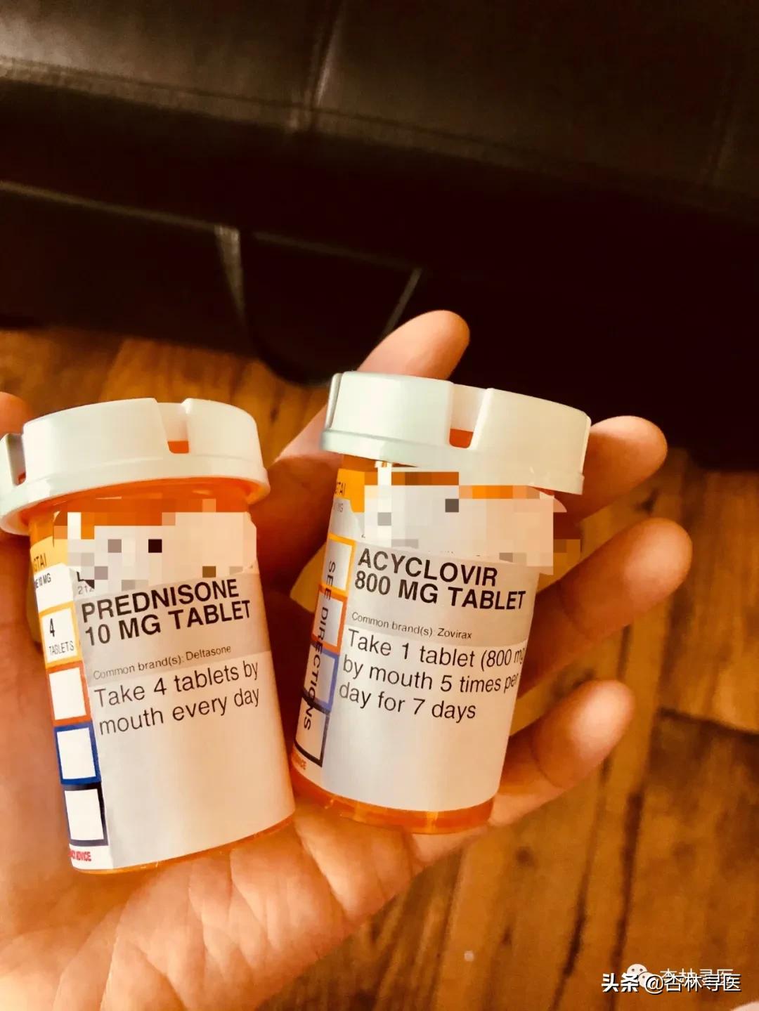 带状疱疹可以出国吗,得了带状疱疹能出国吗