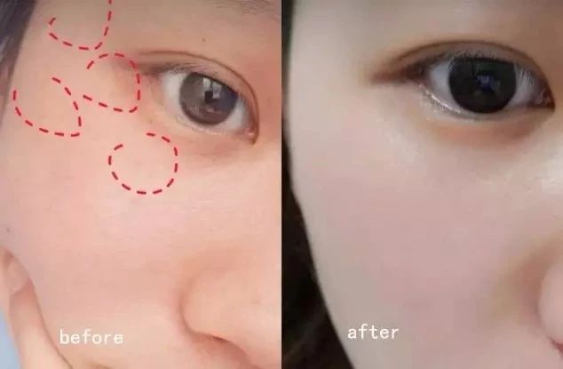 倪妮的肌肤怎么变好看,倪妮护肤