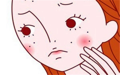 多囊卵巢综合症脸上长痘痘,下巴长痘痘是多囊卵巢综合征