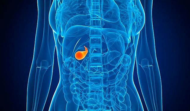 胆囊炎的症状饮食和注意事项,胆囊炎的症状与饮食和治疗