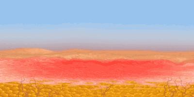 毛孔大皮肤粗糙怎么办,毛孔大皮肤变好