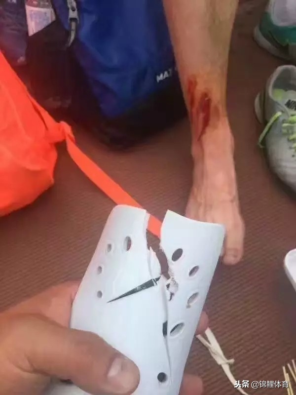 球场暴力事件完整版,球场暴力事件怎么处理