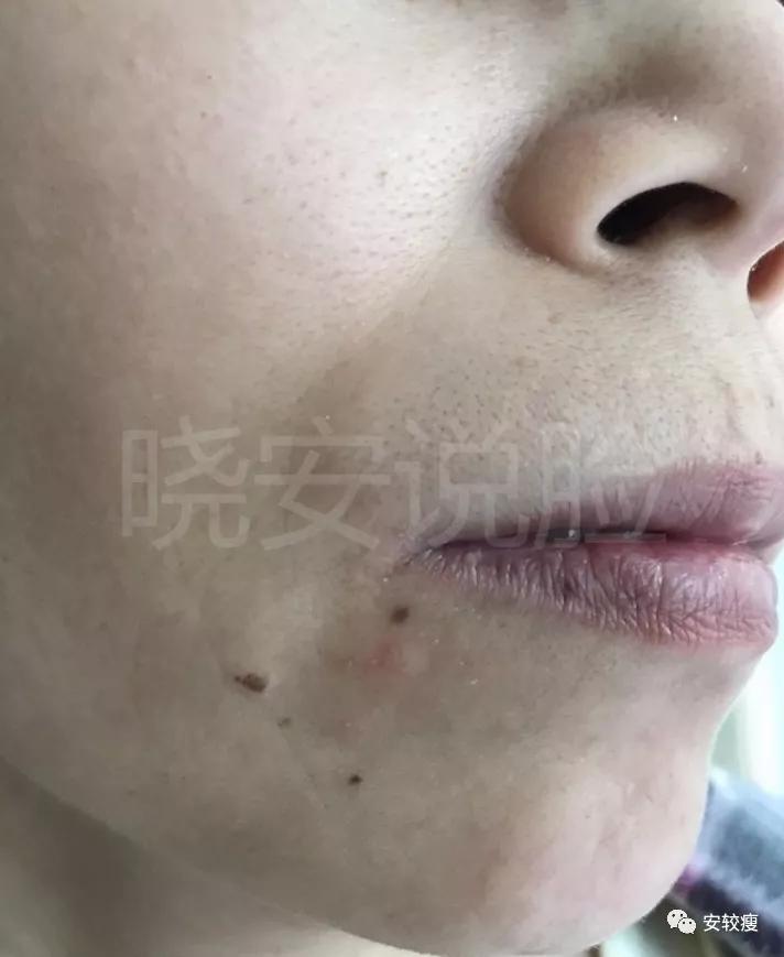 熟龄肌抗皱护肤品,35岁以上好用的抗老抗皱紧致测评