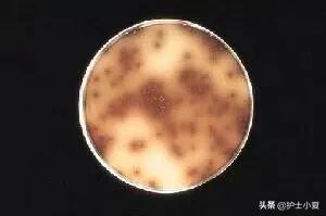 小孩头疼发烧是流感吗,孩子感冒咳嗽发烧头疼怎么回事