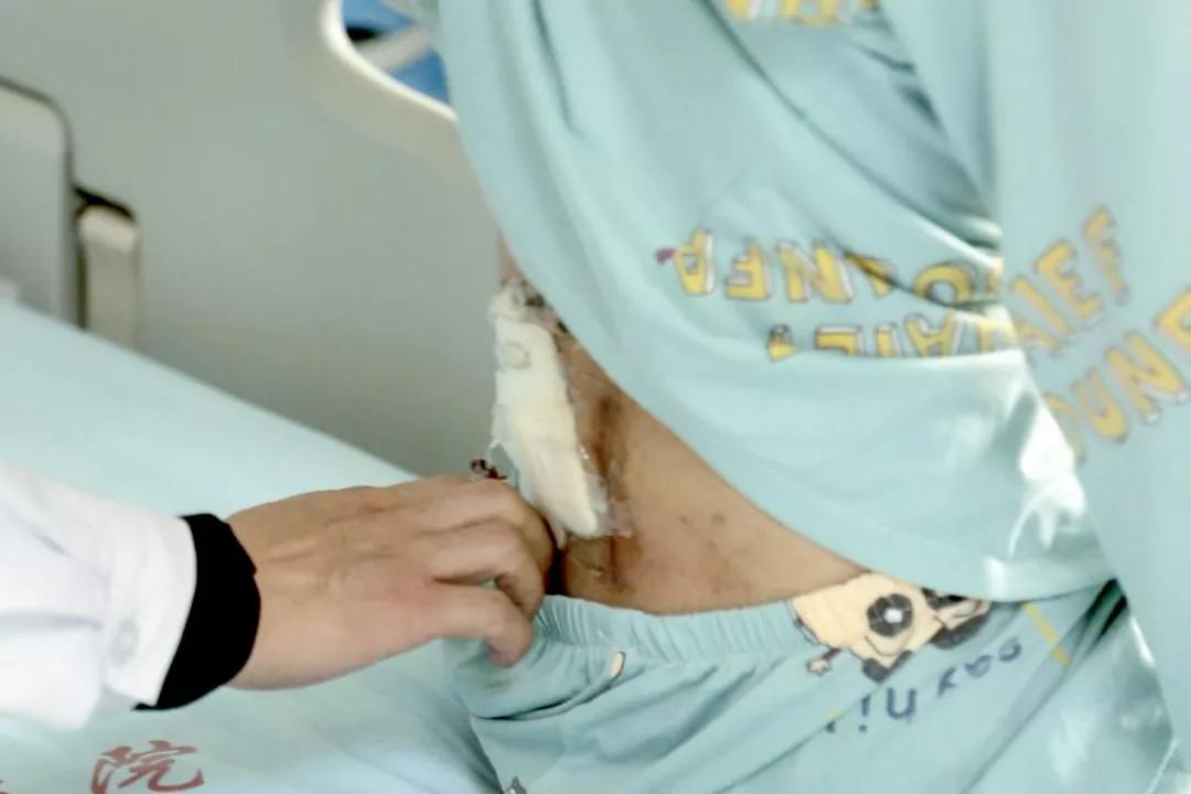 撸串会导致什么病,撸串引起的病症