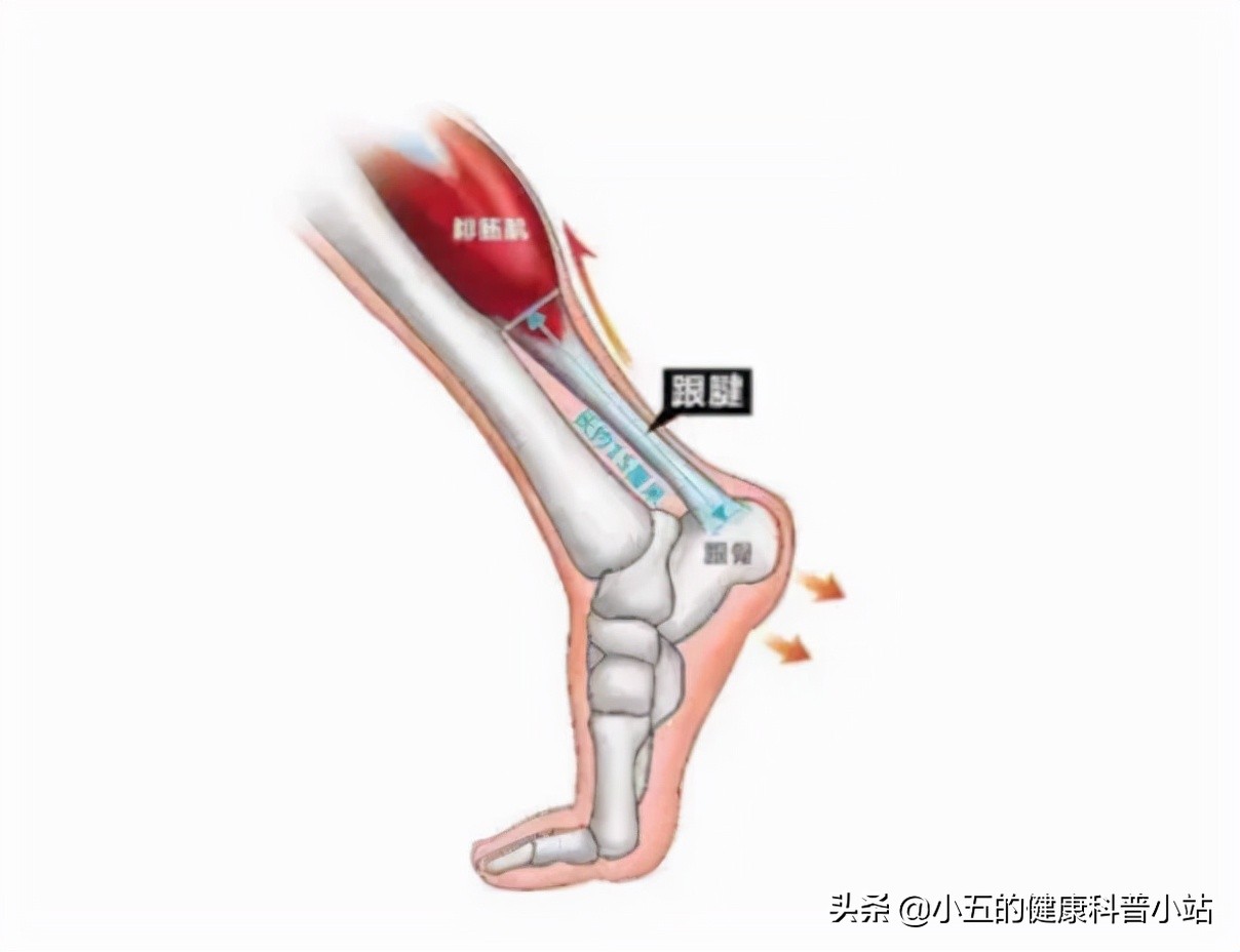 足跟痛的原因和治疗方法,足跟痛的快速解决办法