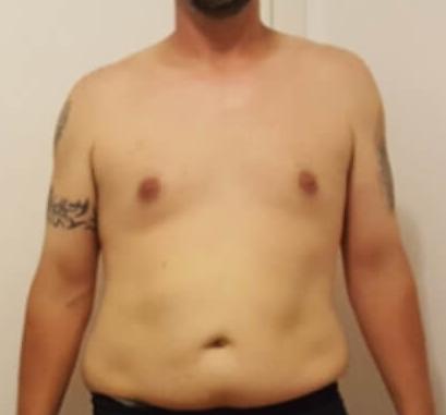 男性胸部脂肪可以锻炼消除吗,男性胸部脂肪俯卧撑可以减下去吗