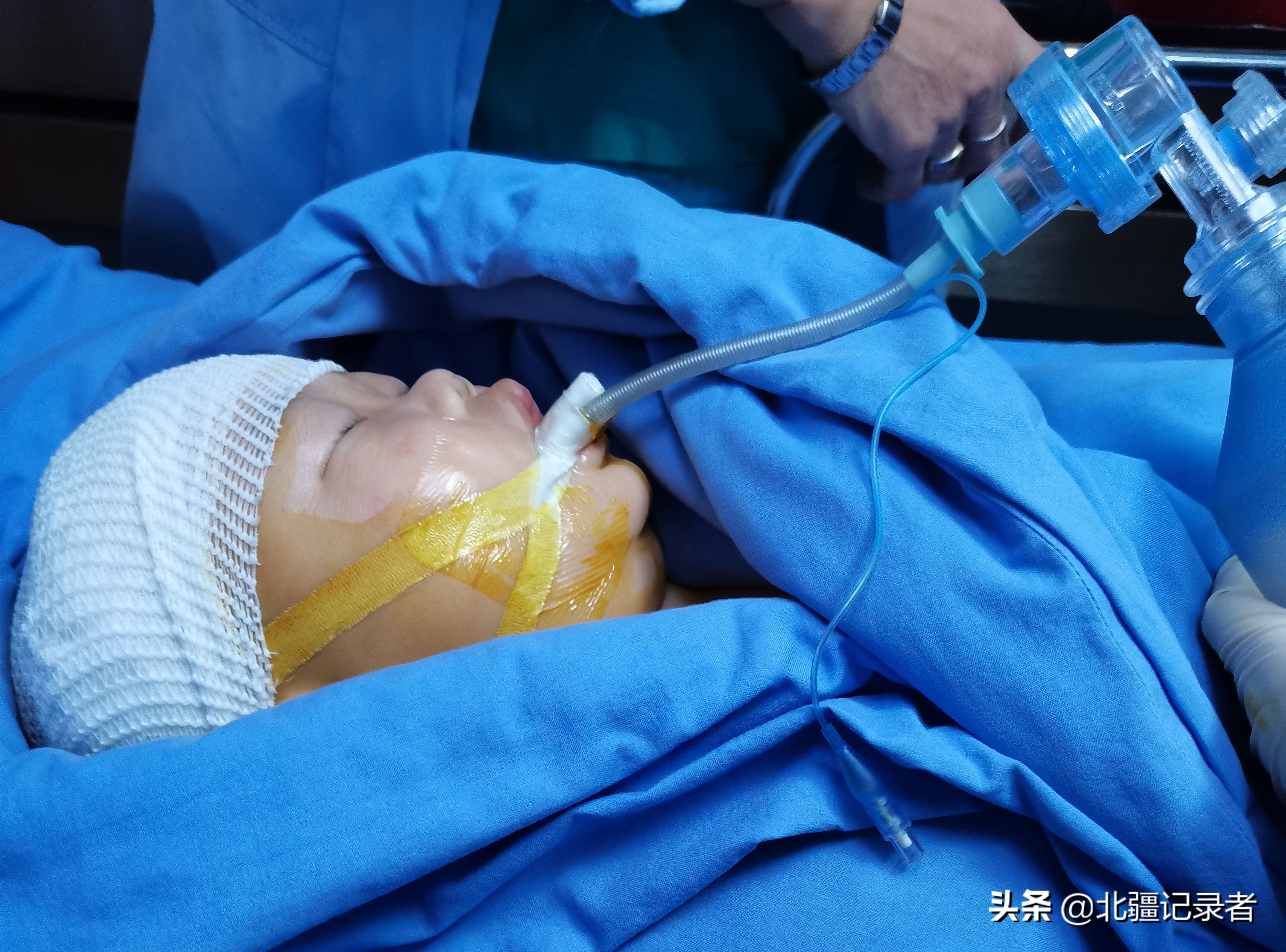 小孩咳嗽厉害突然死亡,孩子因为支气管肺炎住院的视频