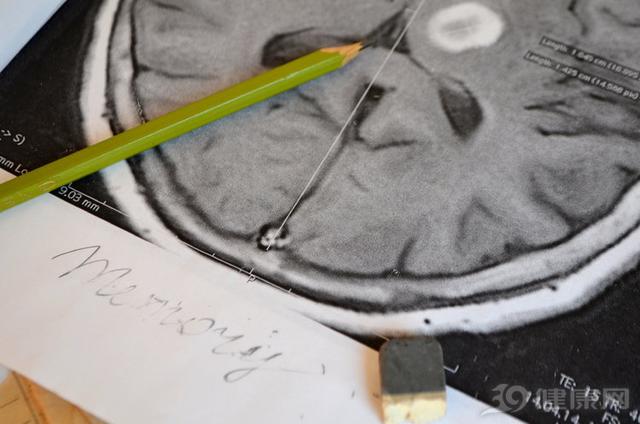 身体出现这三个症状可能是脑溢血,身体出现这5个表现