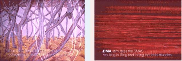 家用射频仪哪个效果最好,女明星逆龄回春