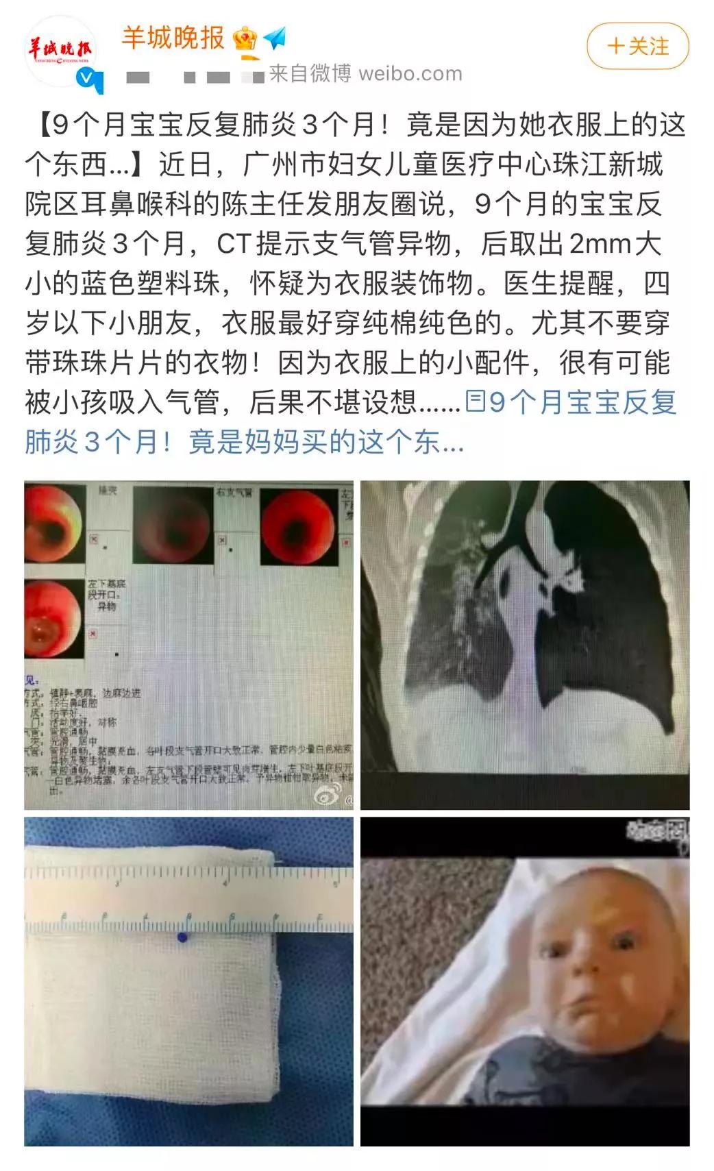 这几种危险夺命童装别买,家长注意这种童装很危险别买