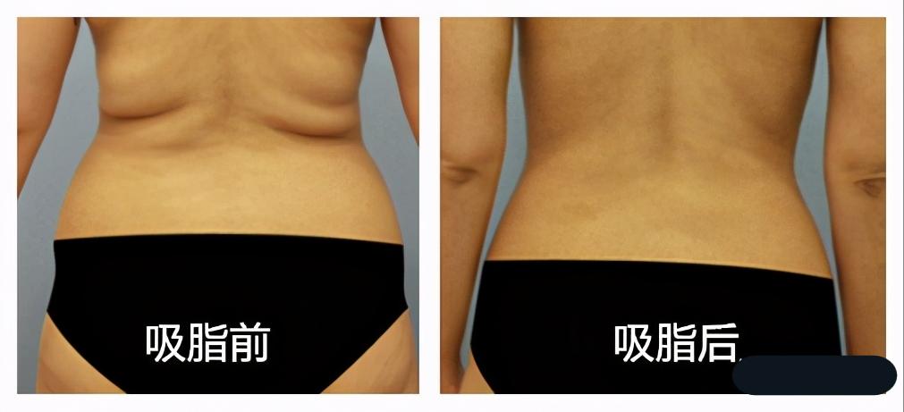 医美踩过的坑自述,医美经验100个坑