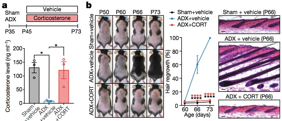 压力大掉头发是怎么回事,压力大掉头发咋办