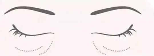 你的黑眼圈是怎么治好的,黑眼圈就是如此熬来的