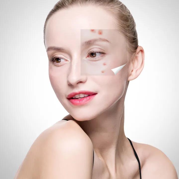 毛孔粗大黑头粉刺闭口护肤测评,毛孔粗大有闭口如何护肤