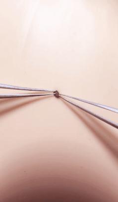 我在快手上看人切洋葱，竟然弄懂了剖腹产？