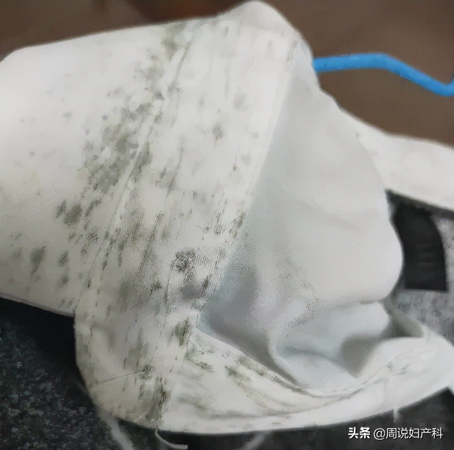 为什么内衣裤霉斑变多了,为什么裤子上穿久了会起霉点