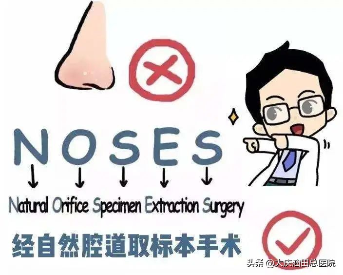 84岁老人直肠癌微创手术,直肠癌手术成功无转移