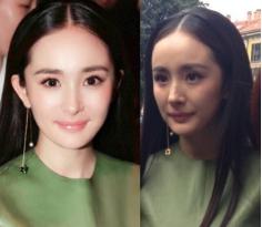 为了变美到底该不该打玻尿酸,玻尿酸注射后变丑了怎么办