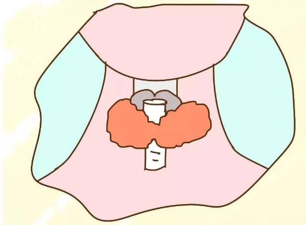 甲亢这种病要不要紧,甲亢好多年了总是反反复复